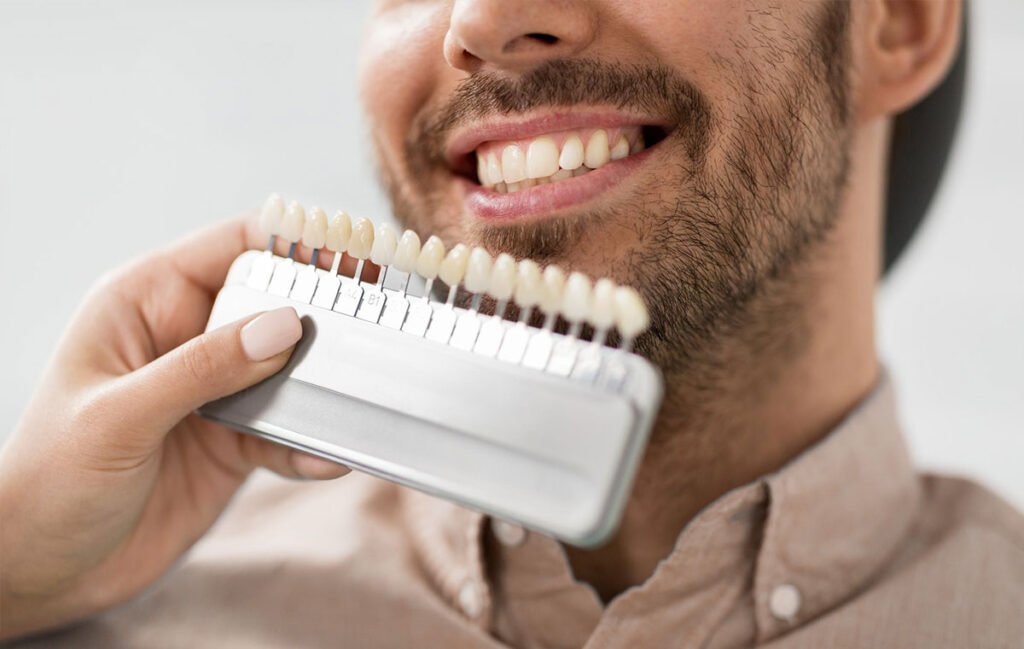 Clareamento dental com Dra. Kelly Pereira em Ribeirão Preto