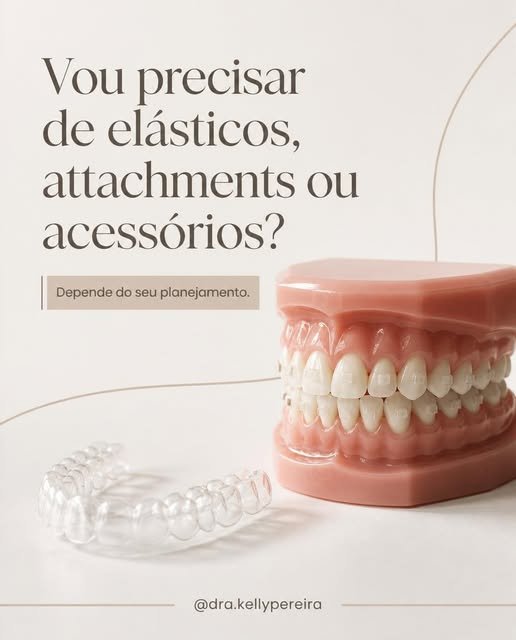 Vou precisar de elásticos, attachments ou acessórios? - Dra. Kelly Pereira, ortodontista em Ribeirão Preto