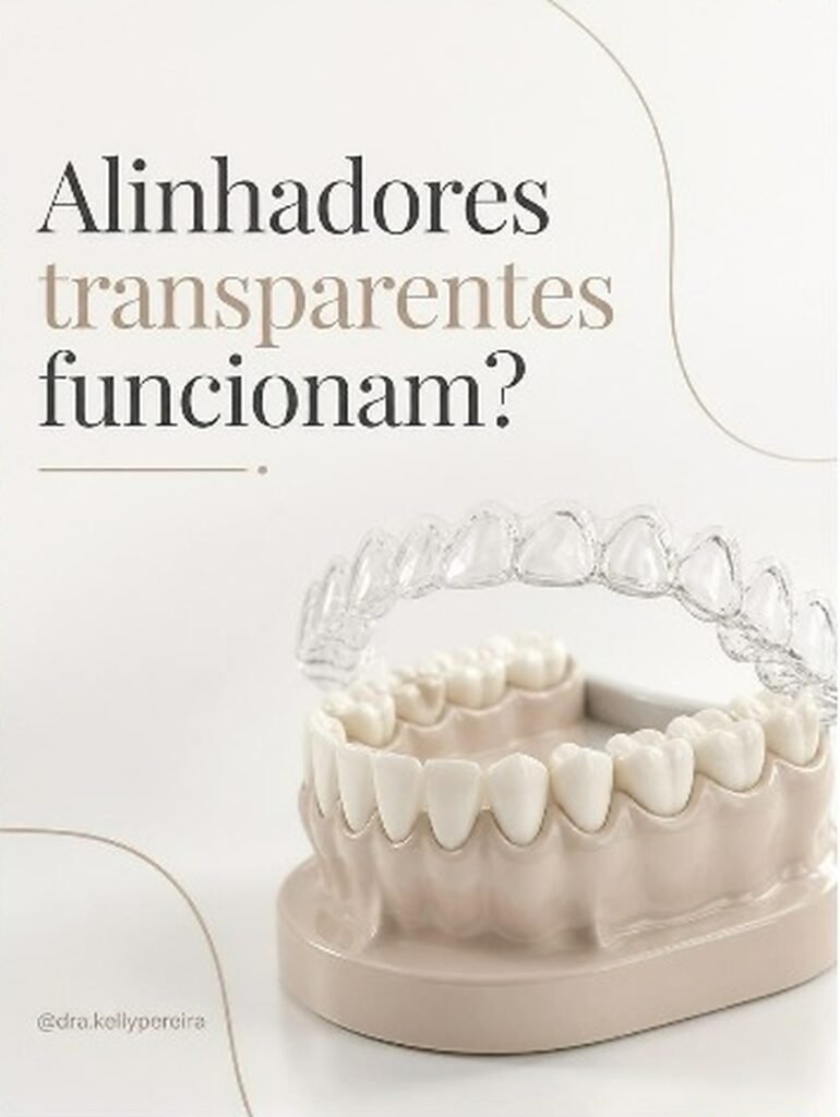 Alinhadores transparentes funcionam? - Dra. Kelly Pereira, ortodontista em Ribeirão Preto