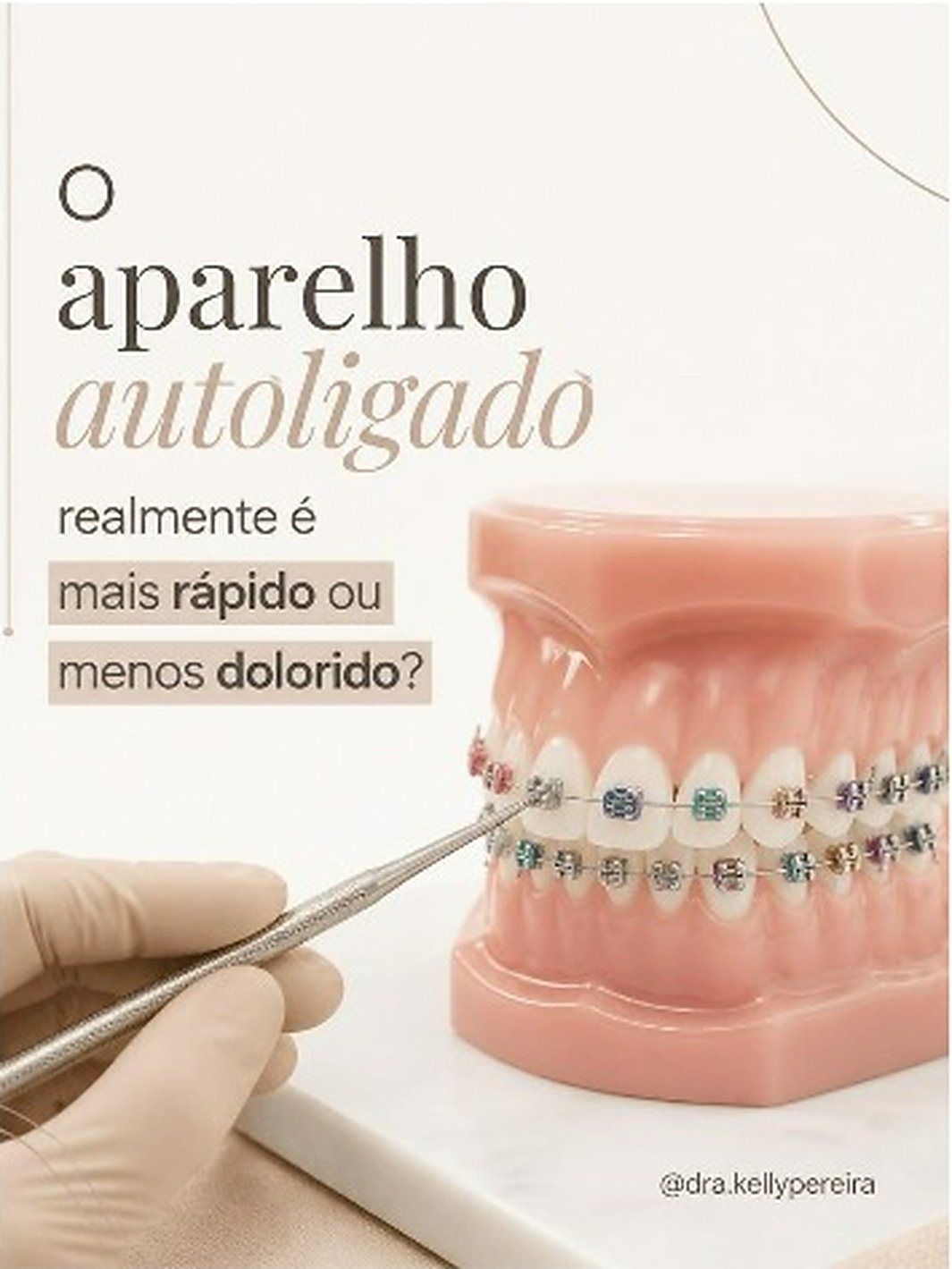 O aparelho autoligado é mais rápido ou menos dolorido? - Dra. Kelly Pereira, ortodontista em Ribeirão Preto