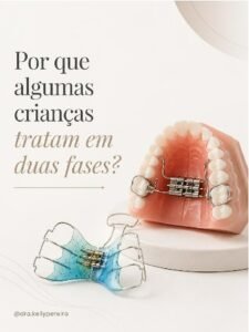Por que algumas crianças tratam em duas fases? - Dra. Kelly Pereira, ortodontista em Ribeirão Preto
