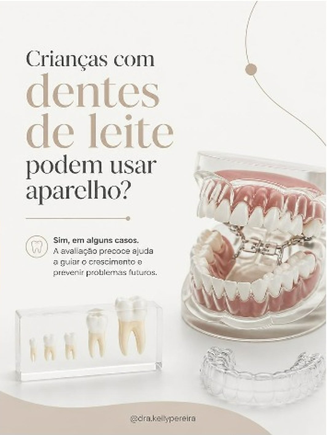 Crianças com dentes de leite podem usar aparelho? - Dra. Kelly Pereira, ortodontista em Ribeirão Preto