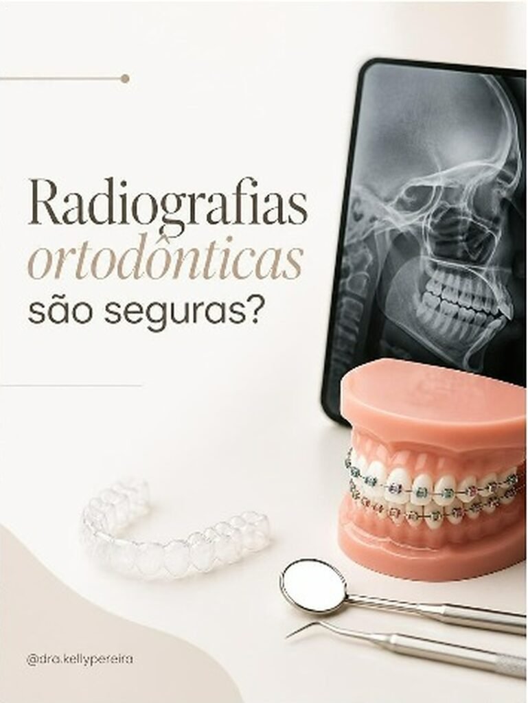 Radiografias ortodônticas são seguras? - Dra. Kelly Pereira, ortodontista em Ribeirão Preto